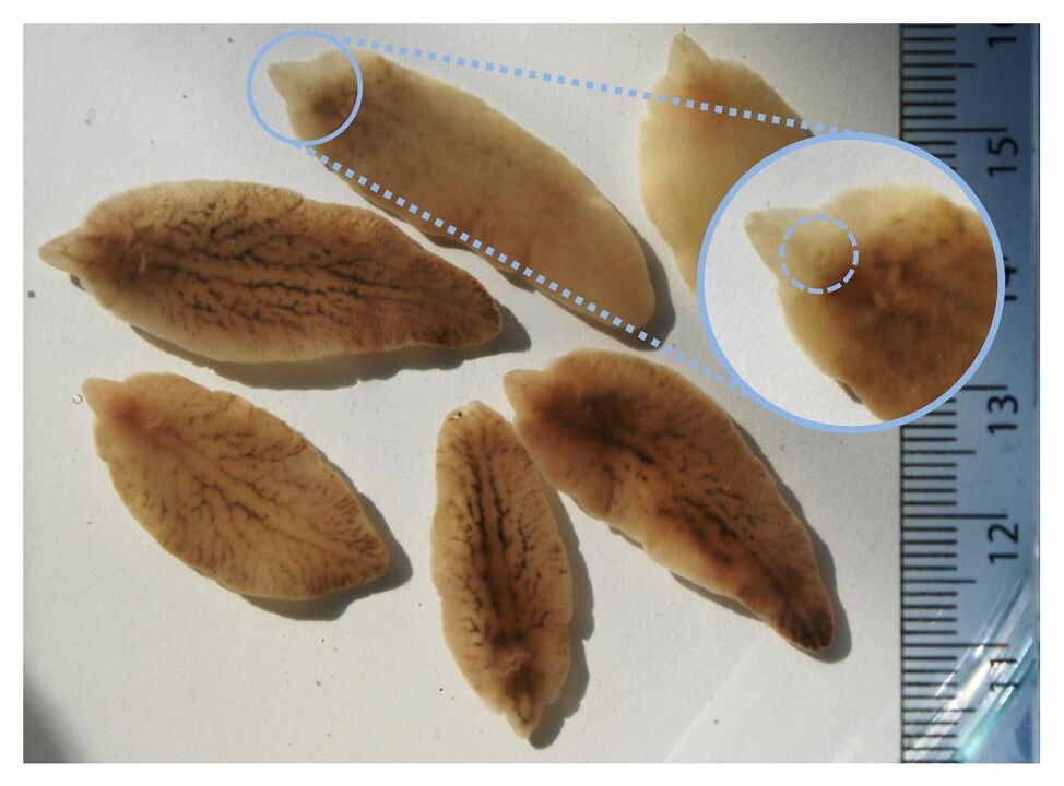 Liver flux