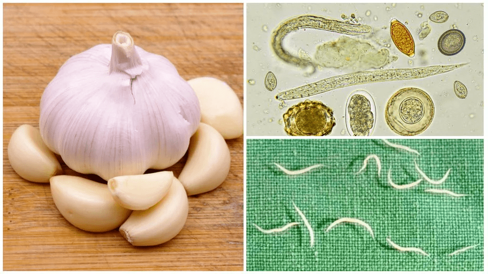 Parasites in the body of the National Method