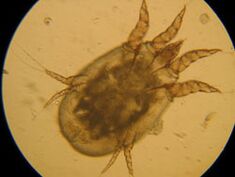 Tick ​​under the microscope